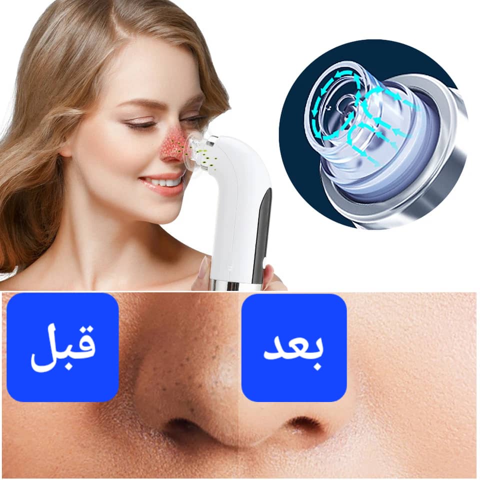 جهاز هيدرافسيال المنزلي